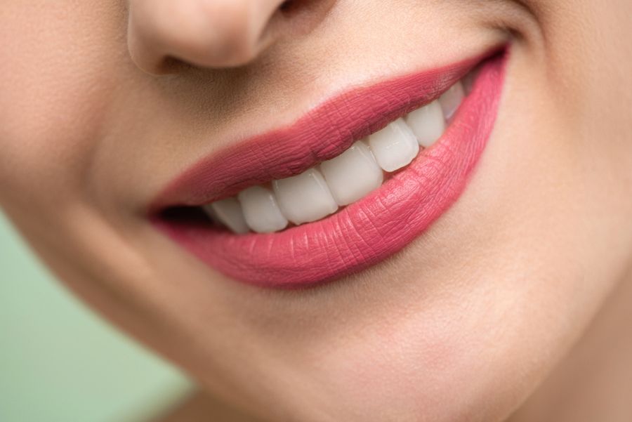 Dental Crowns
