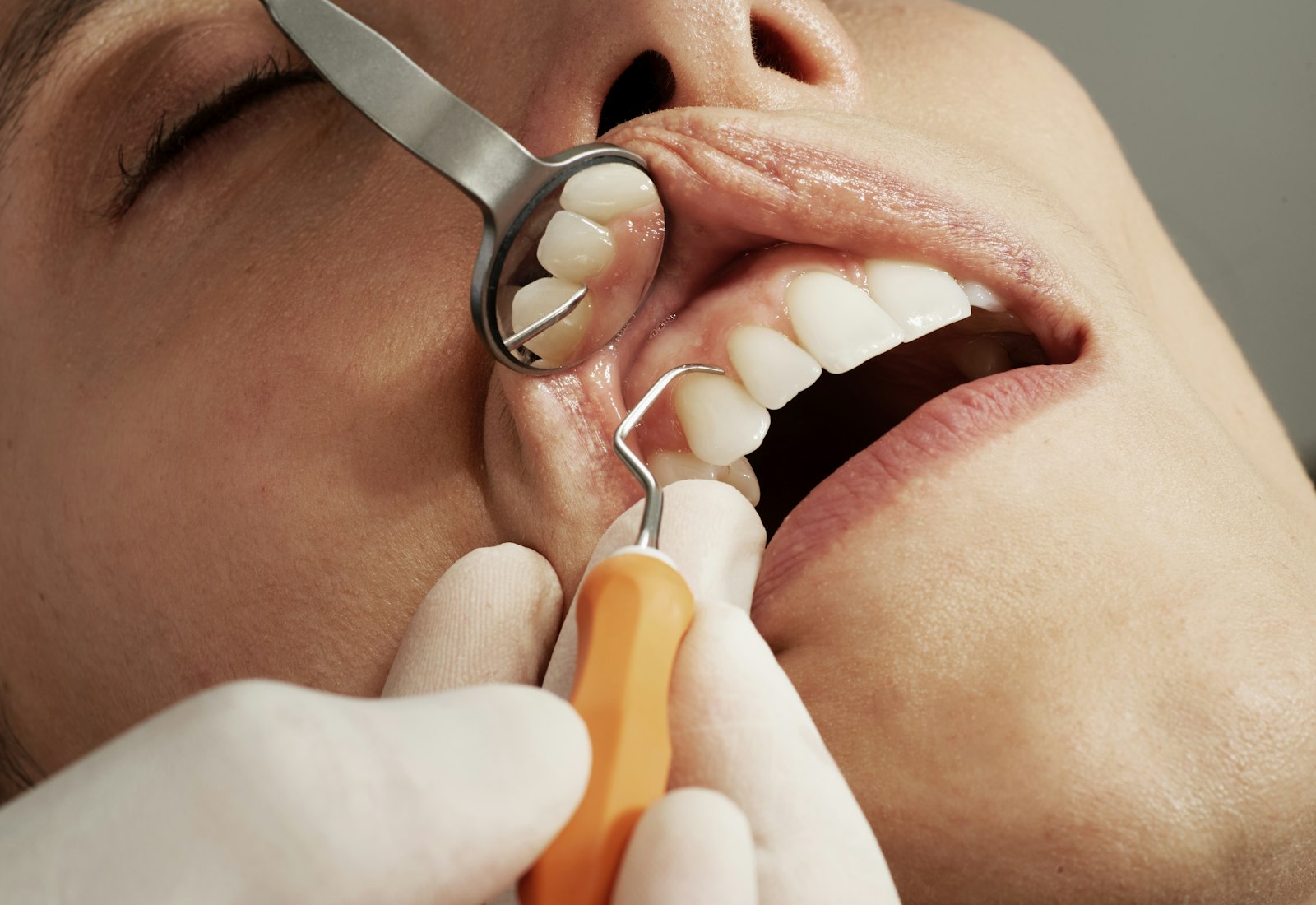 Dental Exams & Checkups