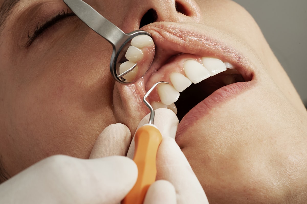 Professional Teeth Whitening