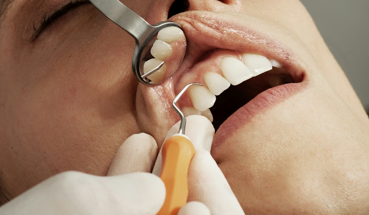 Uneven Tooth Position